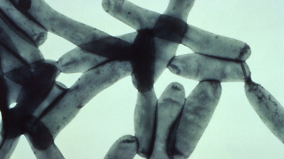 Legion bacteria