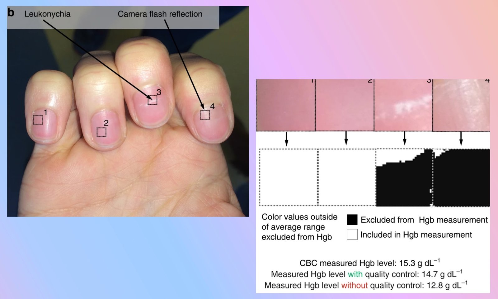 Nail color analysis by mobile application.