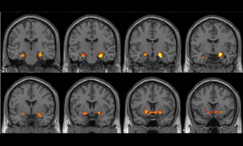 1747577372 This Is What Your Brain Looks Like When You Solve.jpg