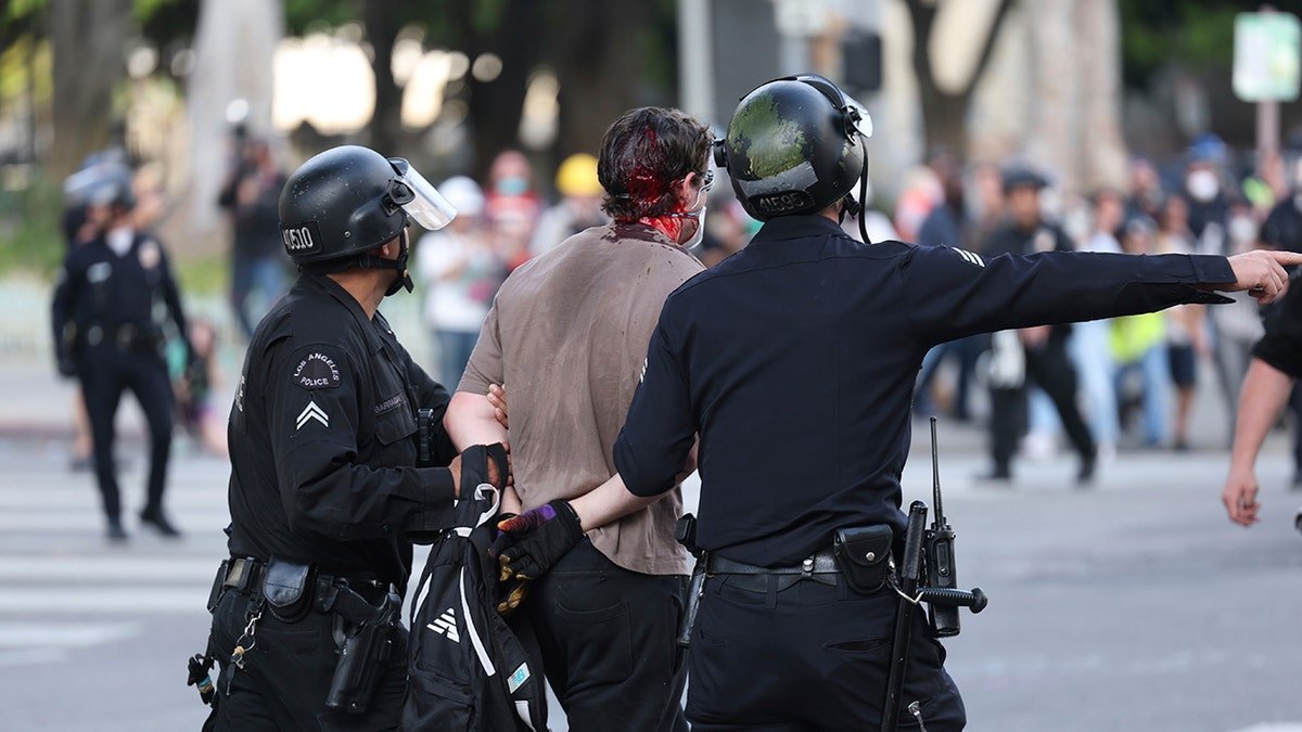 A bloody man was arrested in Los Angeles