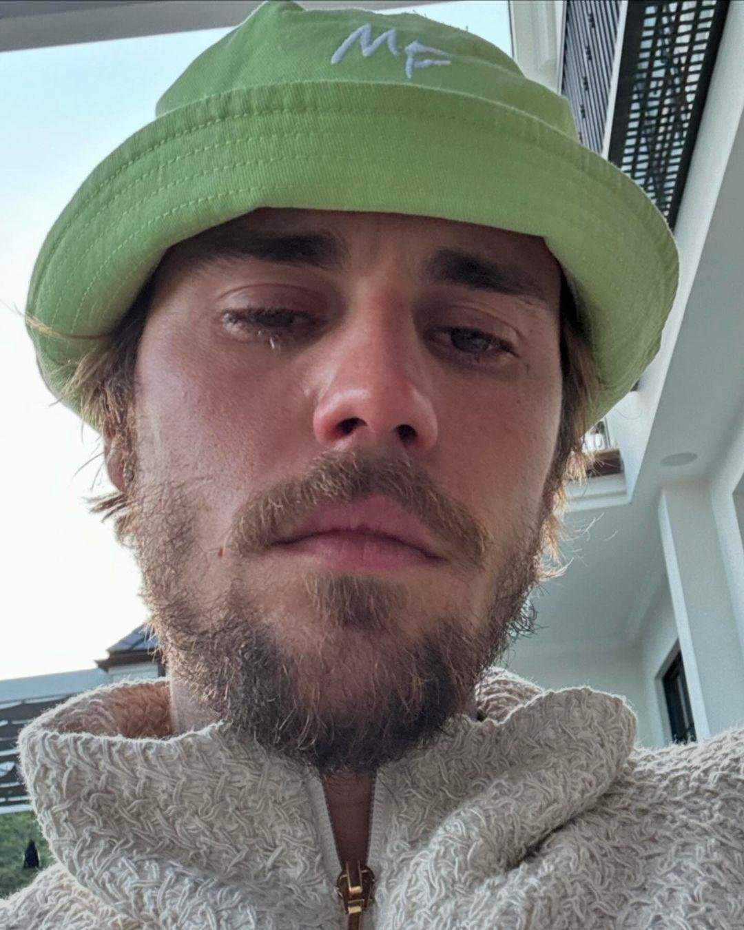 Justin Bieber leaves the fans anxious after sharing pictures of emotional crying pictures
