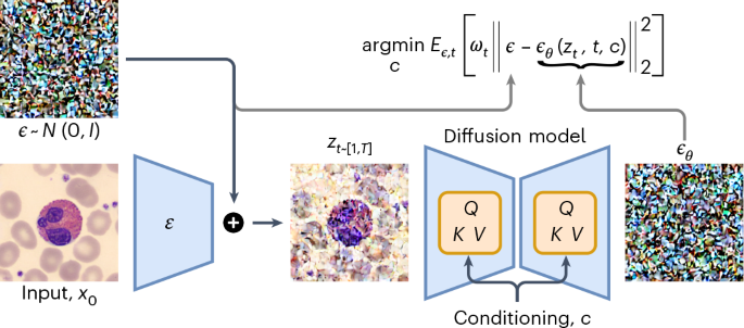 Deep generative classification of blood cell morphology.png