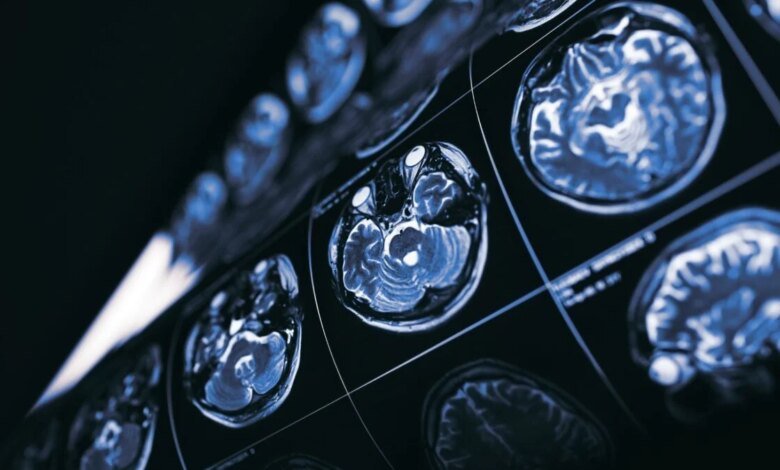 1769462615 What If Cancer Holds the Key to New Treatments for.jpg